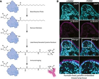 Chemical probe mediated visualization of protein S-palmitoylation in patient tissue samples